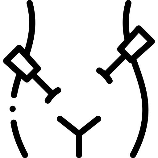 Laparoskopia